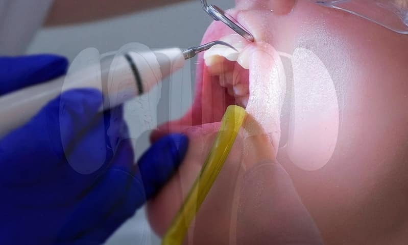 dentist hoverboard prison