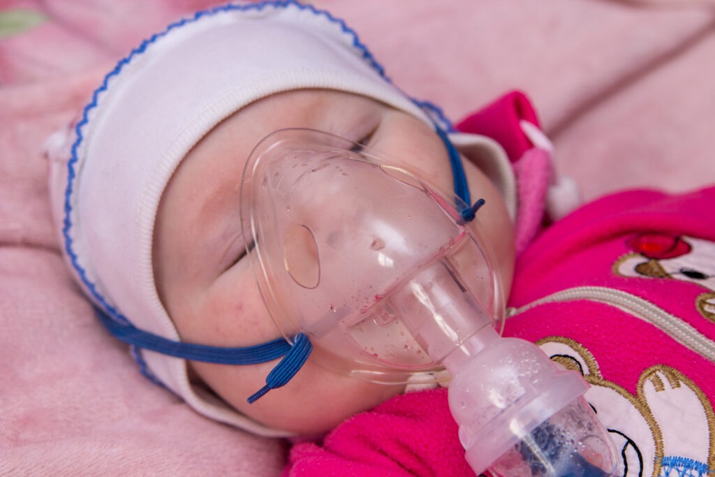 an infant suffering from rsv (Respiratory Syncytial Virus) and is under treatment