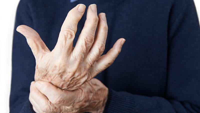 Rheumatoid Arthritis: Actemra Lawsuits