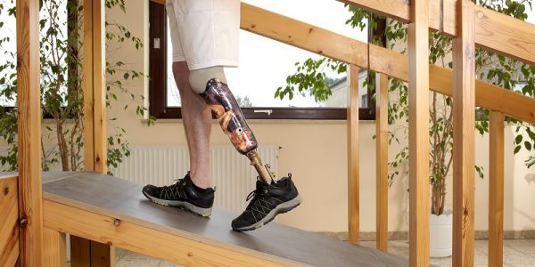 Prosthetic Limbs and the Future of Personal Injury Cases